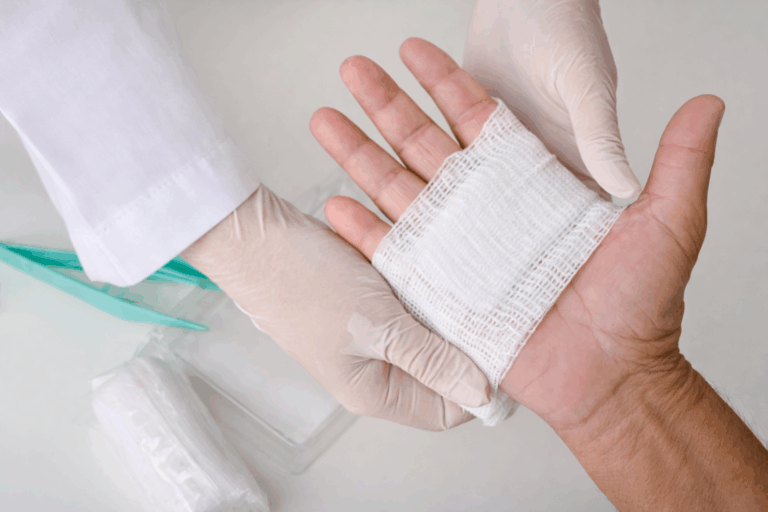 Pessoa recebendo curativo com gaze em queimadura leve primeiros cuidados
